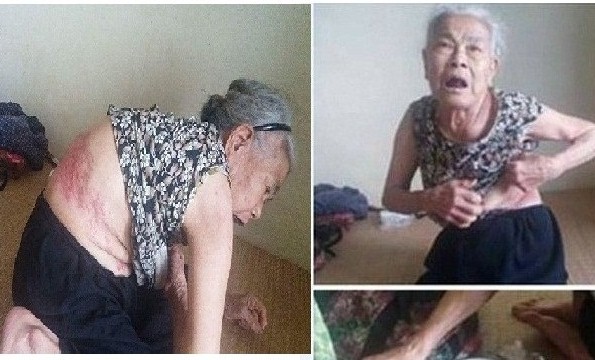 Mẹ già 81 tuổi tố bị con trai đánh gãy xương, đuổi khỏi nhà
