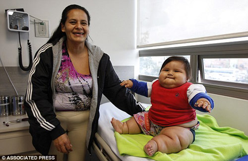 Câu bé  Santiago Mendoza được coi là trẻ sơ sinh nặng nhất Colombia khi mới 8 tháng tuổi nhưng đã 19,7kg – bằng cân nặng của một đứa trẻ 6 tuổi.