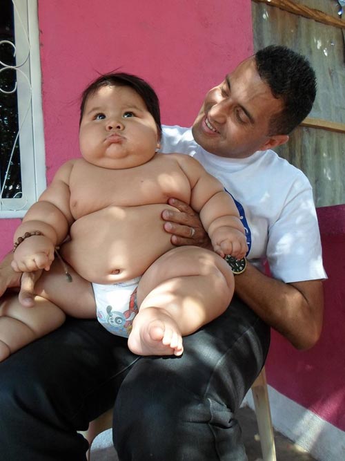 Santiago Mendoza được coi là trẻ sơ sinh nặng nhất Colombia và là một trong những em bé béo nhất thế giới khi mới 8 tháng tuổi nhưng đã 19,7kg – bằng cân nặng của một đứa trẻ 6 tuổi.