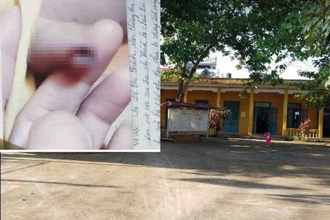 Trường mầm non được cho là nơi xảy ra vụ cô giáo mầm non vụt chảy máu bộ phận sinh dục bé trai 3 tuổi