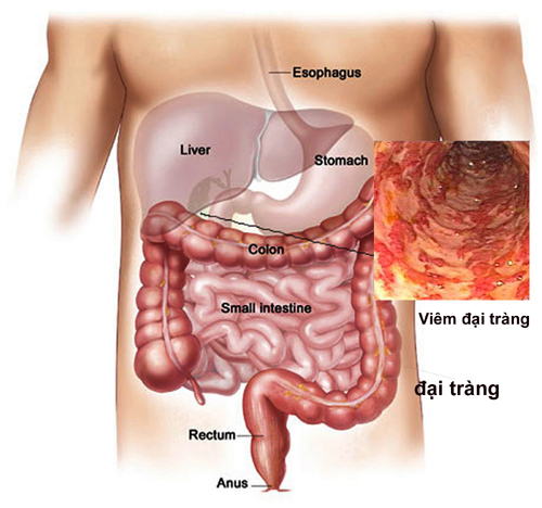 dau-bung-ben-trai-ngang-ron