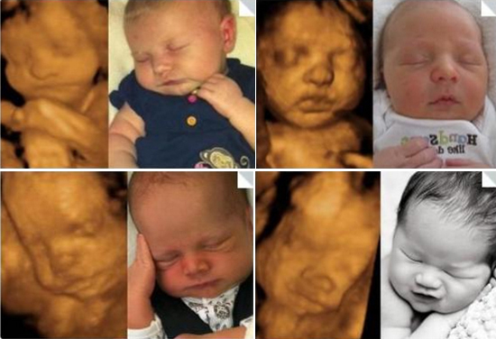 Ảnh siêu âm là kho báu giúp ta giải mã bí ẩn của sự phát triển của thai nhi. Những bức ảnh đáng yêu sẽ không chỉ mang lại niềm vui cho gia đình mà còn giúp các bác sĩ phân tích và đưa ra các vé tư vấn hữu ích trong quá trình mang thai. Hãy lưu giữ những kỷ niệm đáng yêu này bằng những bức ảnh siêu âm tuyệt đẹp.