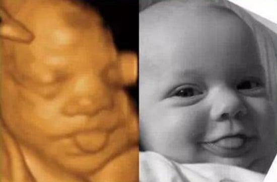 Không gì thú vị hơn là được thưởng thức những bức ảnh siêu âm mặt con đáng yêu vừa được chụp trực tiếp. Bạn sẽ cảm nhận được sự thật sự rõ ràng về sự trưởng thành của thai nhi trong quá trình mang thai và tự hào khi được chia sẻ với gia đình và bạn bè.
