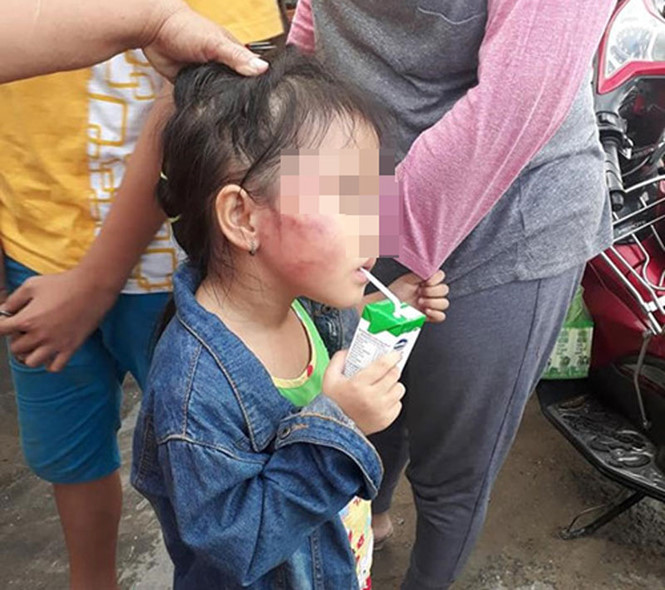 Bé gái 5 tuổi bị cô giáo tát sưng mặt hiện đã được đưa về quê