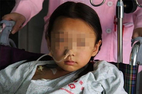 Bé gái 10 tuổi ở Trung Quốc bị ung thư tuyến giáp vì ăn nhiều đồ ăn nhanh. Ảnh minh họa