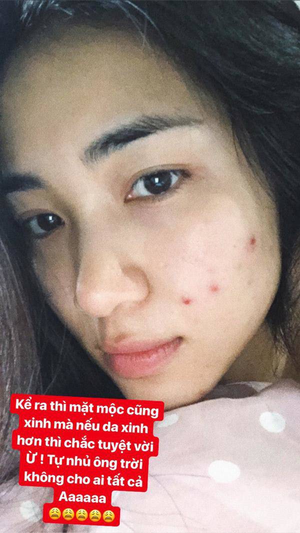 Cũng có lúc nhan sắc cô bị xuống cấp trầm trọng do mụn mọc khắp nơi, nhưng nhanh chóng được người đẹp chữa khỏi.