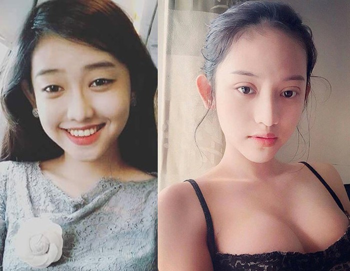 Tình địch của Midu - Thúy Vi cũng là 1 trong những mỹ nhân Việt đã đẹp sẵn rồi vẫn đi phẫu thuật thẩm mỹ.