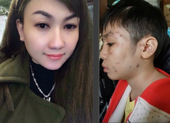 Vụ bé trai 10 tuổi bị bố và mẹ kế đánh rạn sọ não: Chưa một lời hỏi thăm hay một câu xin lỗi!