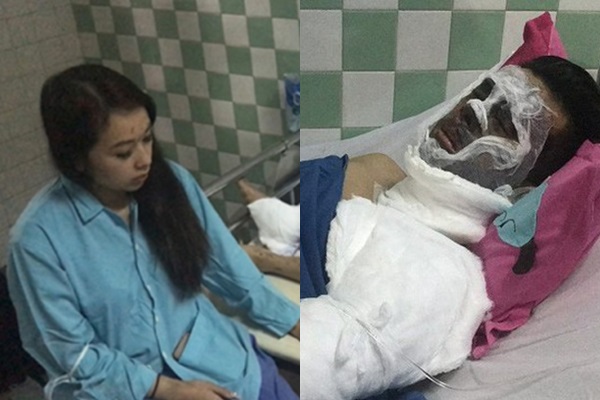 Vụ Việt kiều bị tạt axit, cắt gân chân: Hai cuộc gọi của anh trai nạn nhân tiết lộ điều gì?
