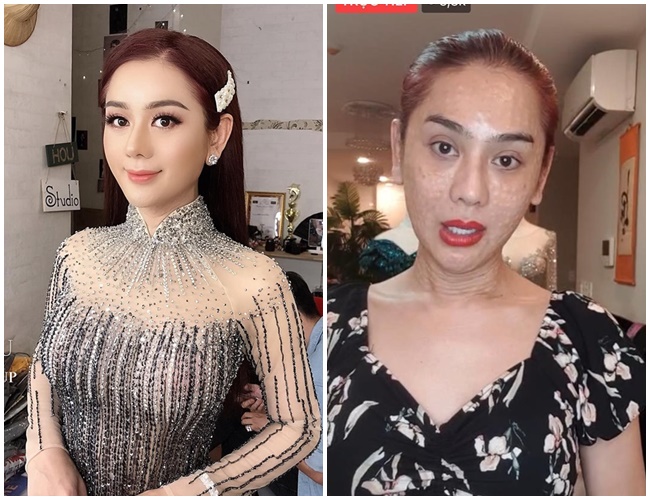Mặc kệ lời đàm tiếu về gương mặt sần sùi, Lâm Khánh Chi vẫn tự tin khẳng định mình đẹp