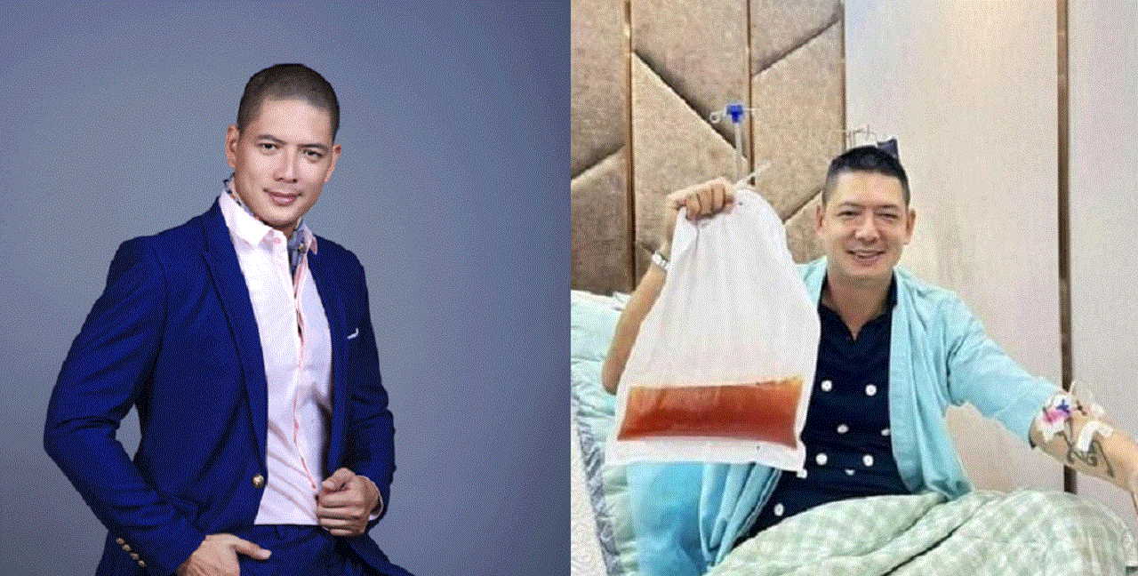 Bình Minh lên tiếng khi bị nghi quảng cáo sai sự thật sau khi đăng ảnh lọc mỡ máu