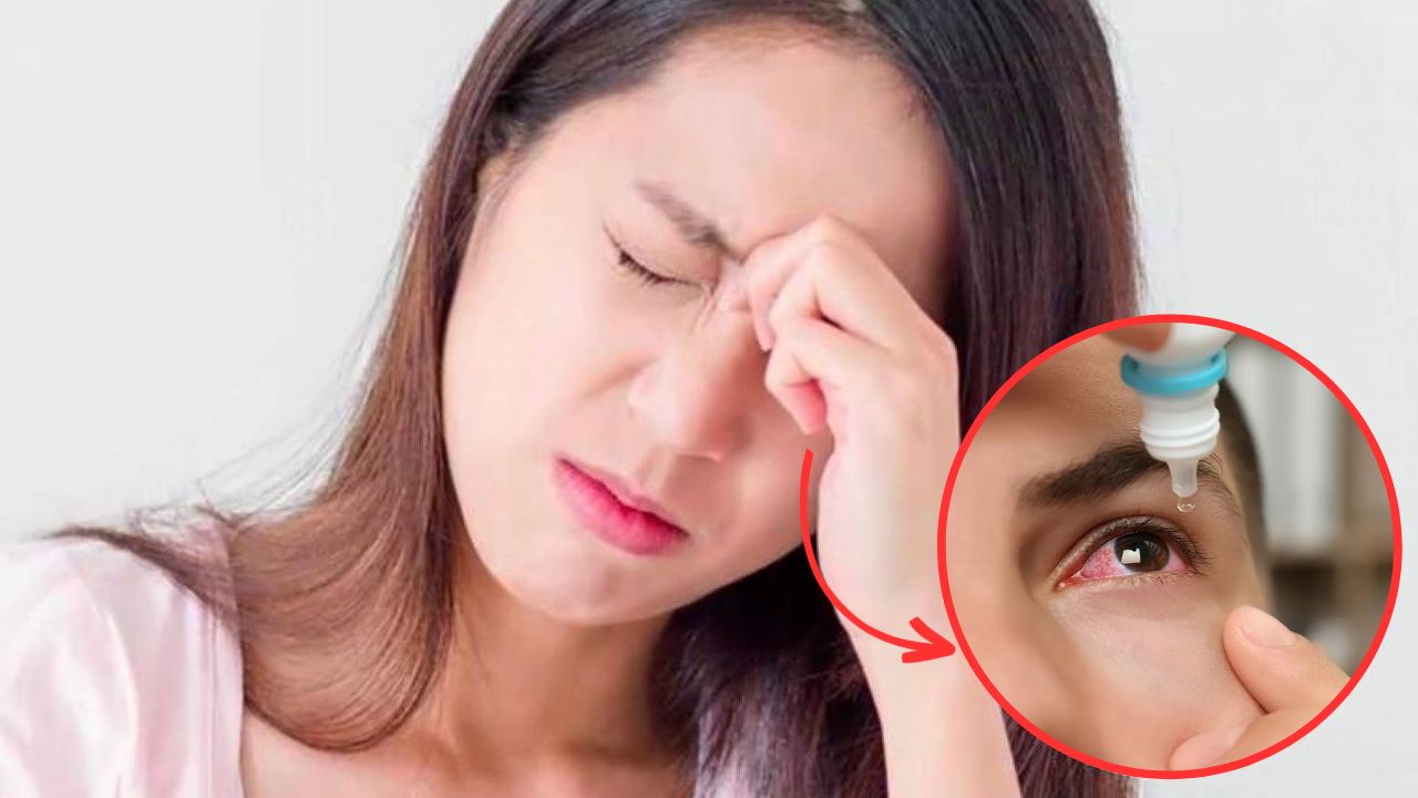 4 cách chữa đau mắt đỏ tại nhà đơn giản, hiệu quả nhanh chóng