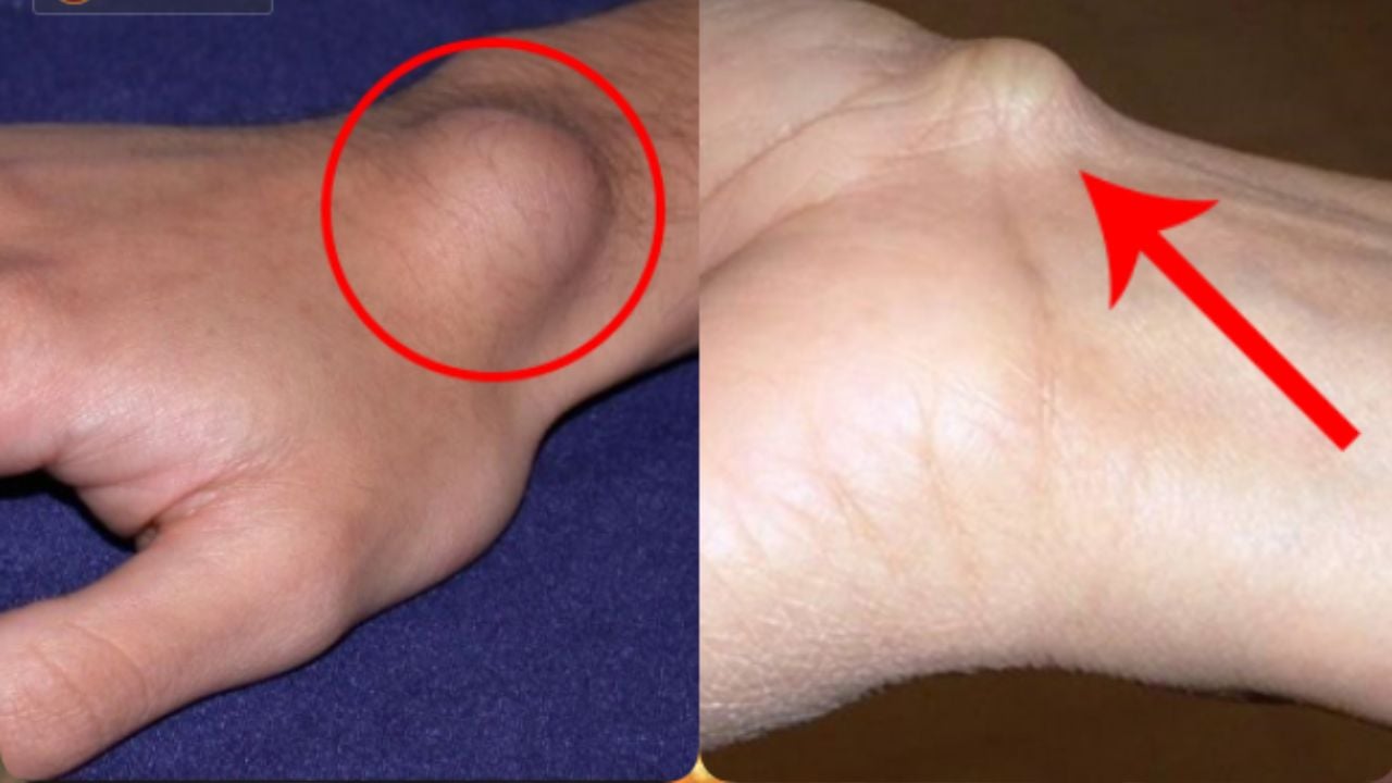 Sáng sớm thấy 4 dấu hiệu này là tế bào K đang tấn công, ăn mòn cơ thể