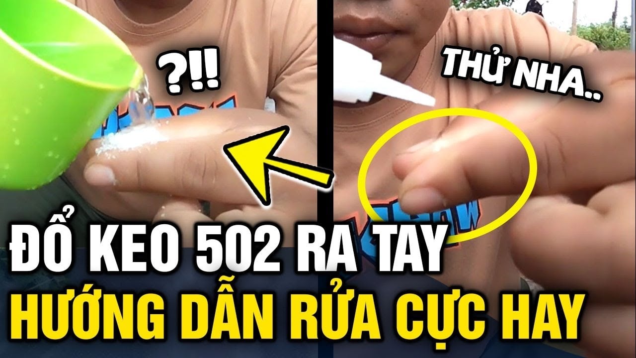 Cách gỡ keo 502 dính trên tay và đồ dùng nhanh nhất, không lo phồng rộp