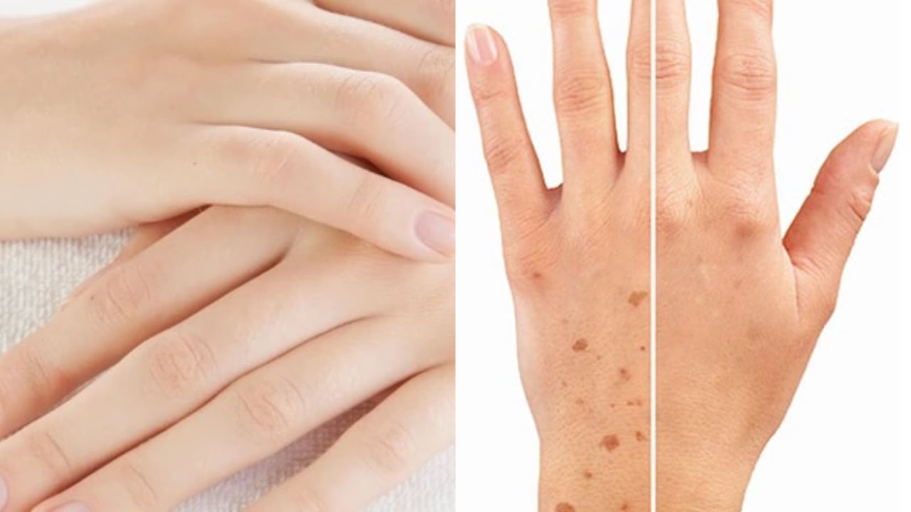 Mu bàn tay tiết lộ bí mật sống thọ: 4 dấu hiệu ai cũng nên kiểm tra