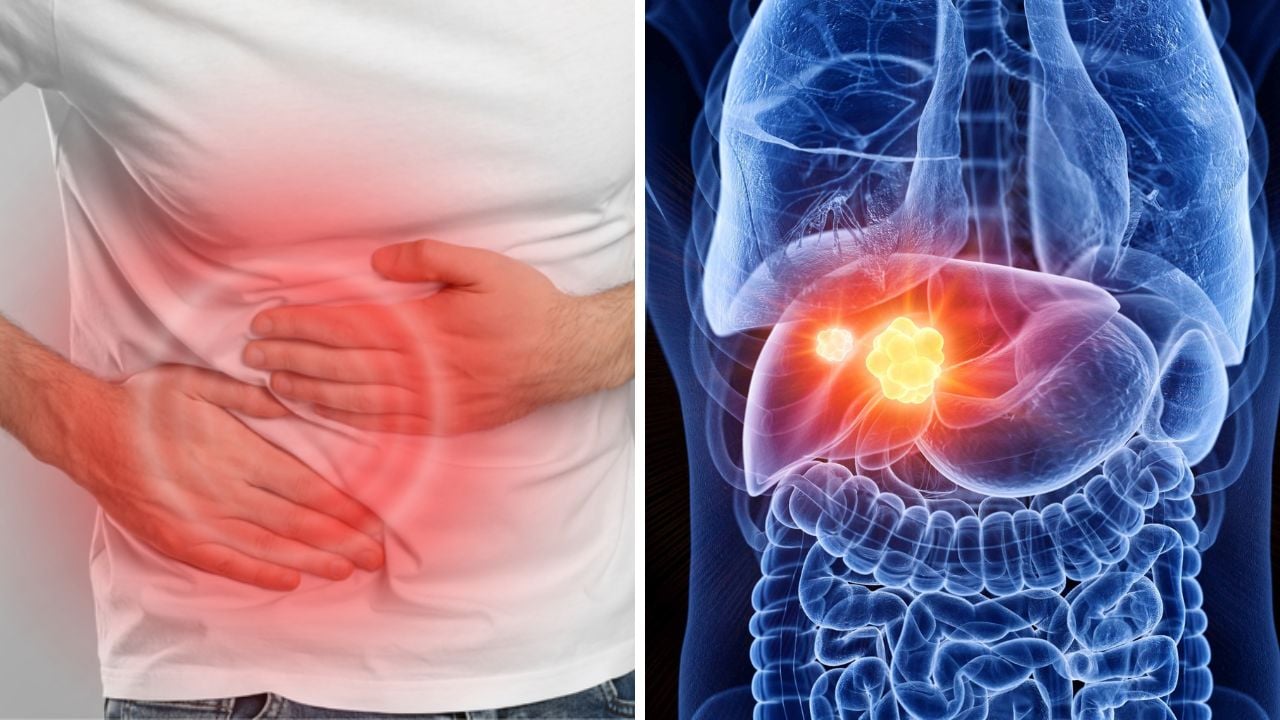 2 đau 1 vàng” dấu hiệu cảnh báo ung thư gan đang âm thầm phát triển: Chủ  quan tính mạng tính từng ngày