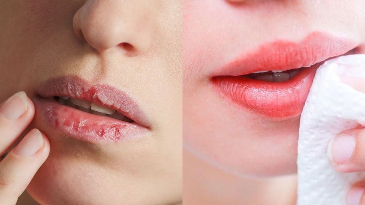 Cách trị môi khô nứt nẻ bằng nguyên liệu sẵn có tại nhà để mùa đông khô  hanh nhưng môi vẫn căng mọng
