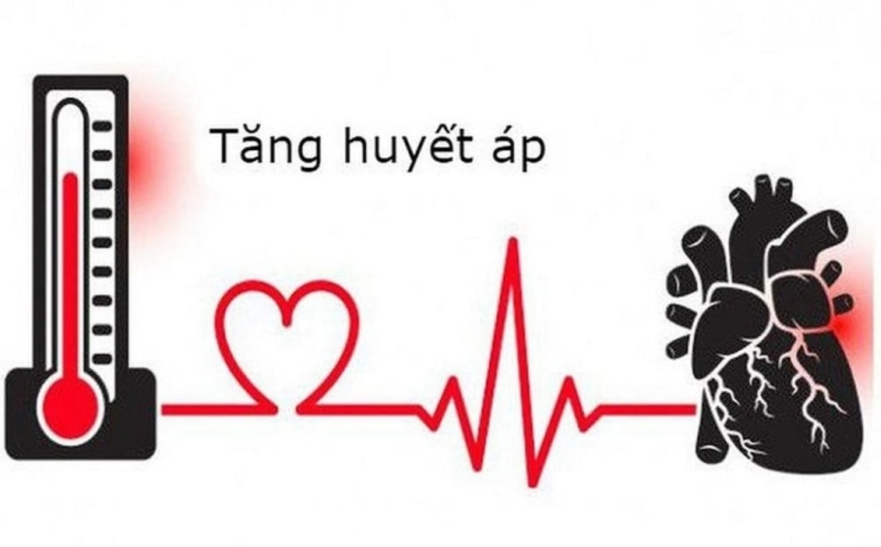 Các bác sĩ tim mạch cho biết, hiện chưa có phương pháp điều trị nào giúp loại bỏ hoàn toàn tăng huyết áp. (Ảnh minh họa)