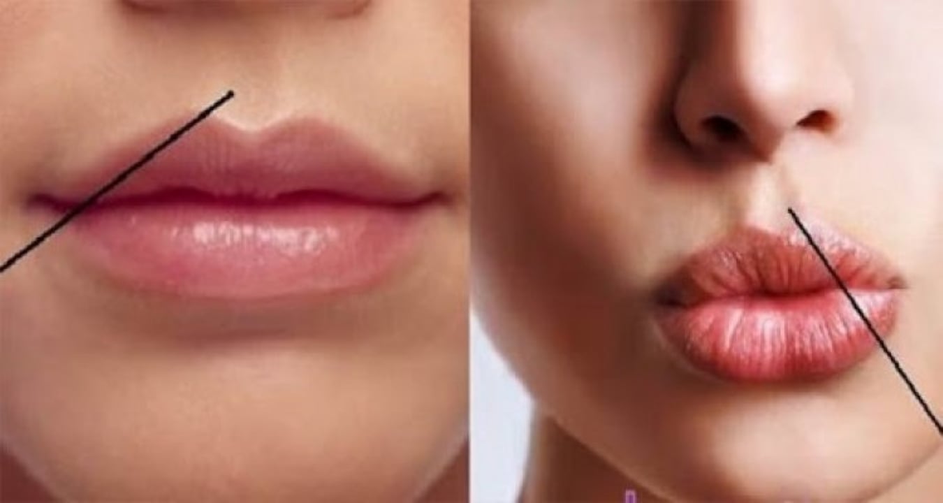 Nếu có 2 vị trí đủ sâu này có trong cơ thể con người thì cơ hội trường thọ càng lớn. (Ảnh minh họa)