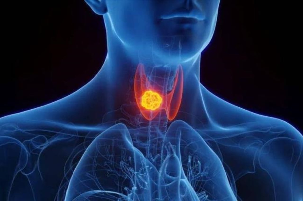 Hãy thay đổi những thói quen xấu trước khi đi ngủ và tránh xa những rắc rối do u tuyến giáp gây ra. (Ảnh minh họa)