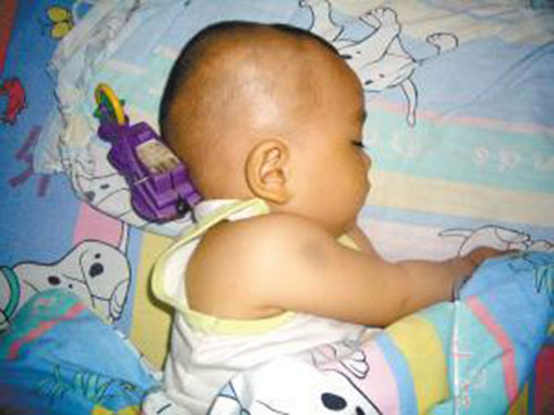 be 11 thang bi do choi cam vao nao, phan ung cua nguoi me khien bac si tam tac - 1