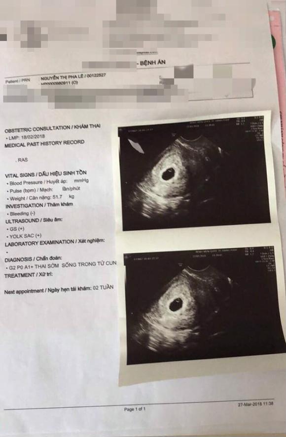Pha Lê chia sẻ anh chụp siêu âm khi mang thai.