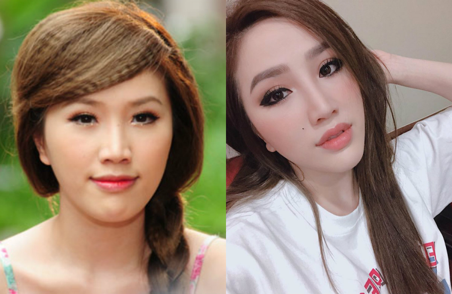 Sự thay đổi trông thấy trên gương mặt: cằm thon gọn hơn, bờ môi căng mọng,... nghi vấn phẫu thuật thẩm mỹ càng thêm có cơ sở.