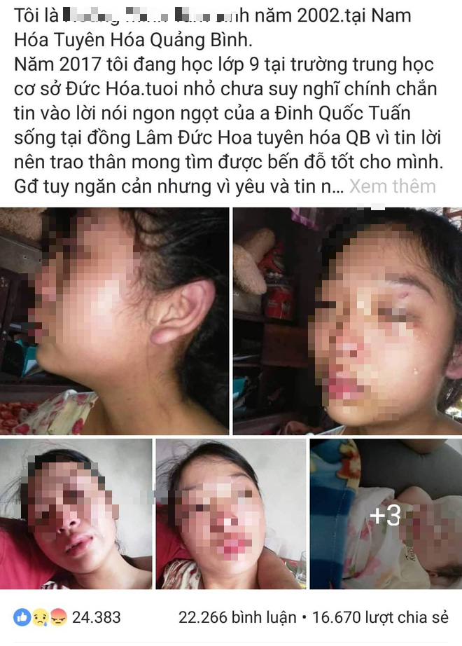 Chị T đăng hình ảnh bị chồng đánh đập lên facebook cá nhân.