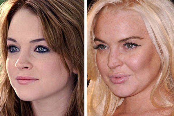 Tuy tiêm botox và bơm môi để làm đẹp, nhưng điều trớ trêu là Lindsay Lohan lại... không đẹp hơn trước.    