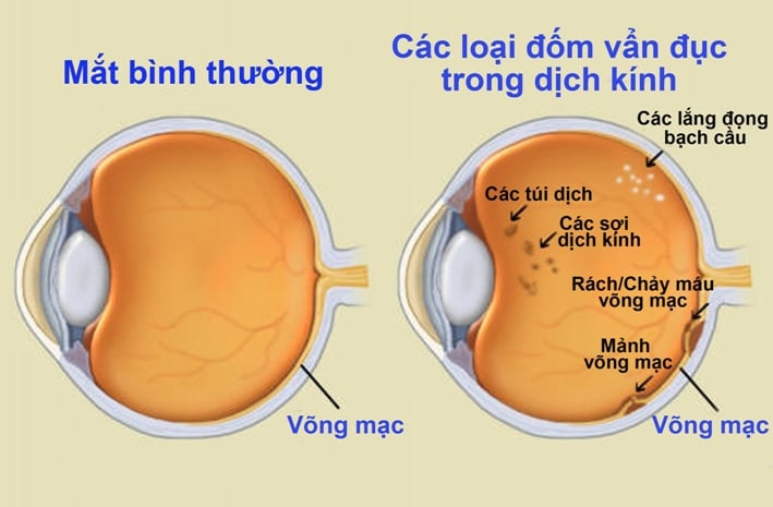 van-duc-dich-kinh-co-chua-duoc-khong