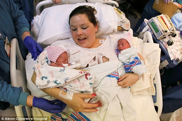 hình ảnh xúc động của cặp chị em song sinh nắm tay nhau khi chào đời