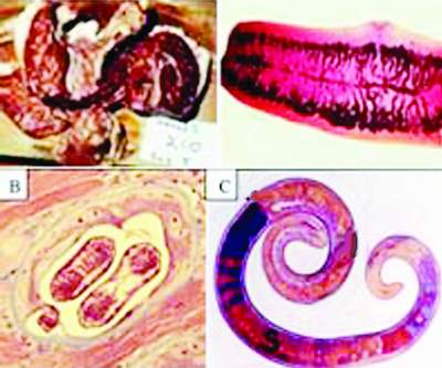 Viêm não, sức khỏe, giun xoắn, tiết canh, ẩm thực, chữa bệnh, đau răng, ăn uống, răng lợi, làm mẹ, chăm con, gia đình, phụ nữ, cuộc sống