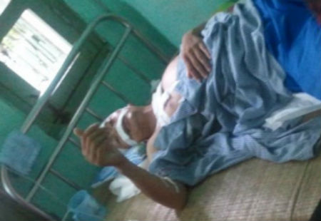Nguyễn Văn Điềm đang điều trị tại Bệnh viện