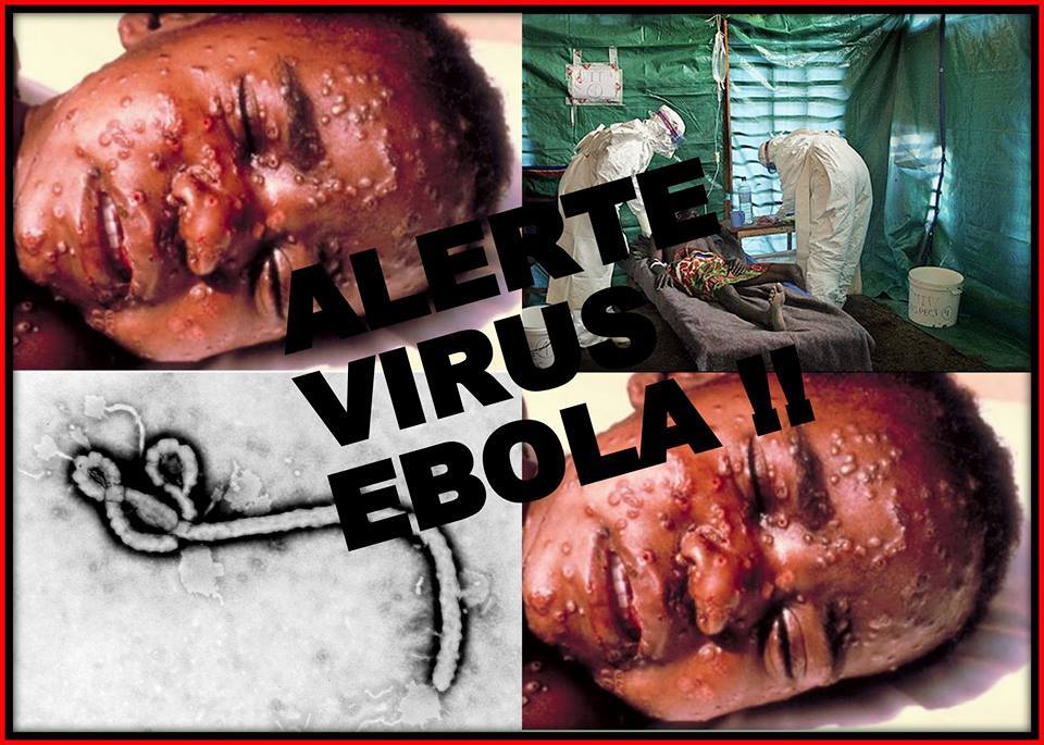Ebola, đại dịch, dịch bệnh, dịch Ebola, vaccine, vaccine ngừa Ebola, sức khỏe, Châu Phi, Mỹ, Trung Quốc, chữa bệnh, trị bệnh