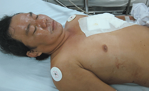 Nghi phạm Ngô Tấn Tài bị thương đang điều trị tại bệnh viện Chợ Rẫy