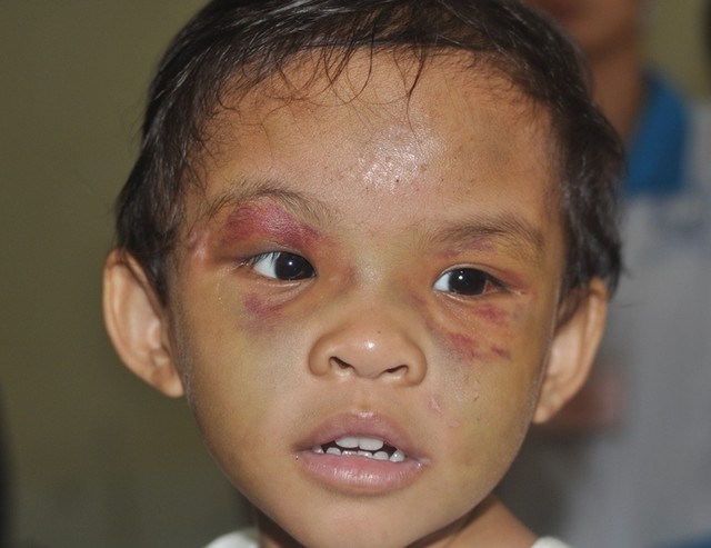 bé gái 4 tuổi bị bạo hành