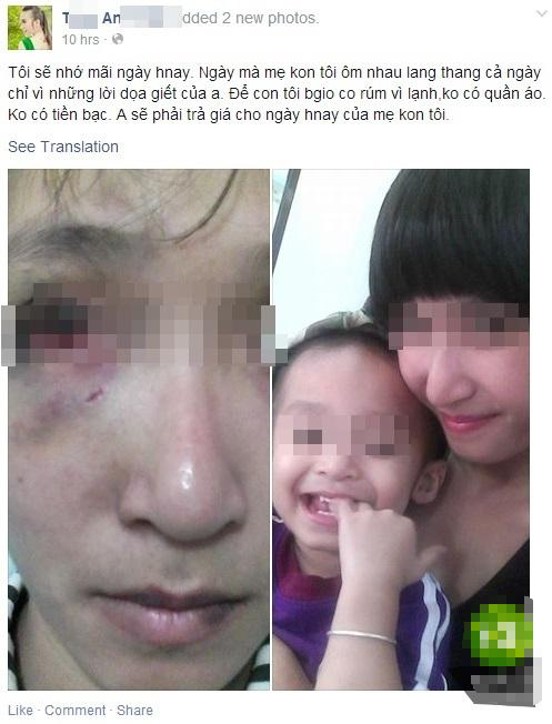 cô gái bị chồng bạo hành đến khóc ra máu