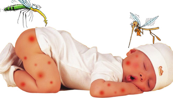 làm mẹ, nuôi con, mẹo hay, có thể bạn chưa biết, xử lý khi muỗi cắn