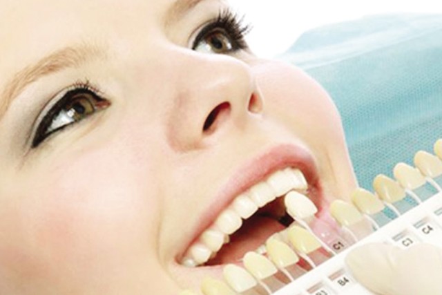 Tẩy răng không đúng cách làm viêm lợi, chết tủy