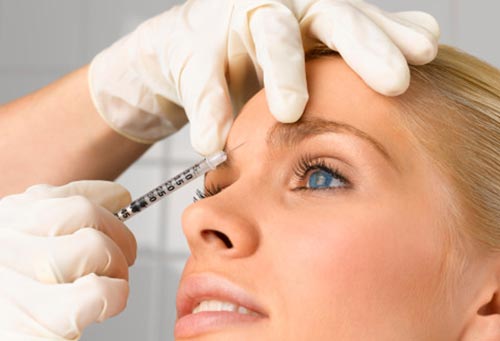 tiêm botox giảm nếp nhăn 