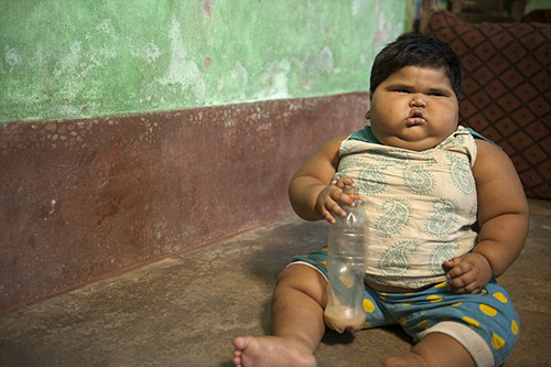 Bé gái 18 tháng tuổi nặng 24 kg khiến bố mẹ lo sốt vó