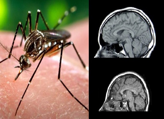 Con đường truyền bệnh Zika cho 2 bệnh nhân Việt Nam là do muỗi
