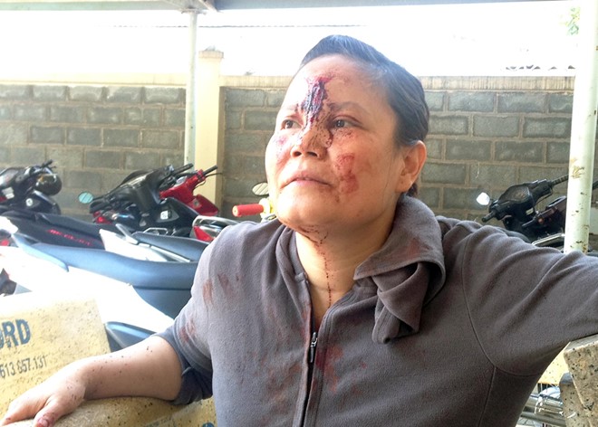 Một phụ nữ bị đánh trọng thương tại trung tâm môi giới việc làm