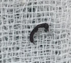 Con kiến dài 5mm được gắp ra từ tai bệnh nhi 10 tuổi.