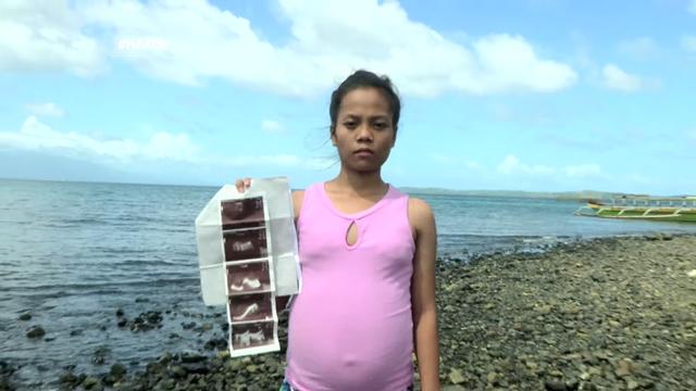 Cô gái nghi bị mang thai với cá.