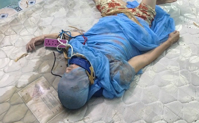 Bà Trương bị con trai đóng đinh vào đầu để trị