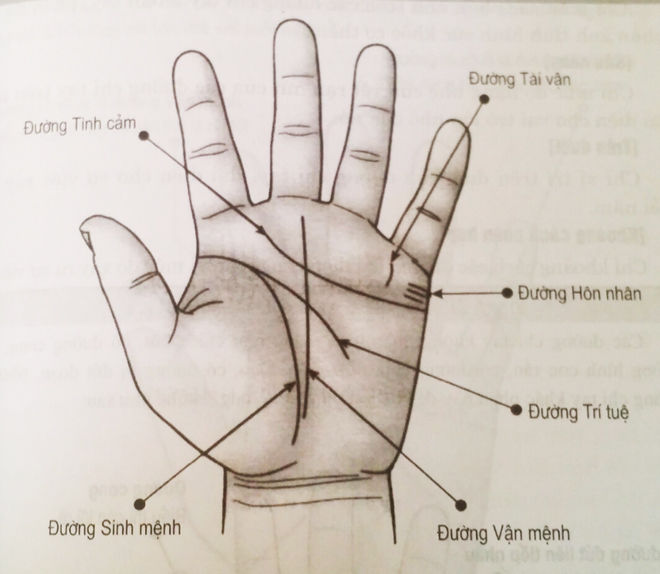 a3