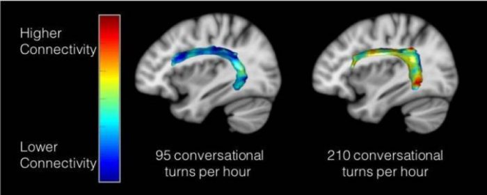 Hình ảnh mô tả kết quả chụp cộng hưởng từ chức năng trên hai nhóm trẻ. Nhóm trẻ có trải nghiệm 95 cuộc hội thoại trong một giờ có kết nối não kém hơn (màu xanh dương) so với nhóm trẻ có 210 cuộc hội thoại trong một giờ (màu cam đỏ) trên khu vực não liên kết hai bán cầu.