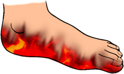 burning-feet