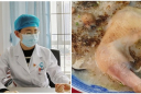 Bác sĩ giải thích lý do cháo gà để tủ lạnh lại gây ngộ độc: Nhiều người vẫn không tin 2 bé qua đời